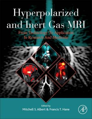 Hyperpolarized and Inert Gas MRI - 