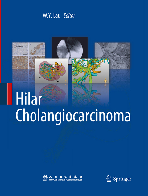 Hilar Cholangiocarcinoma - 