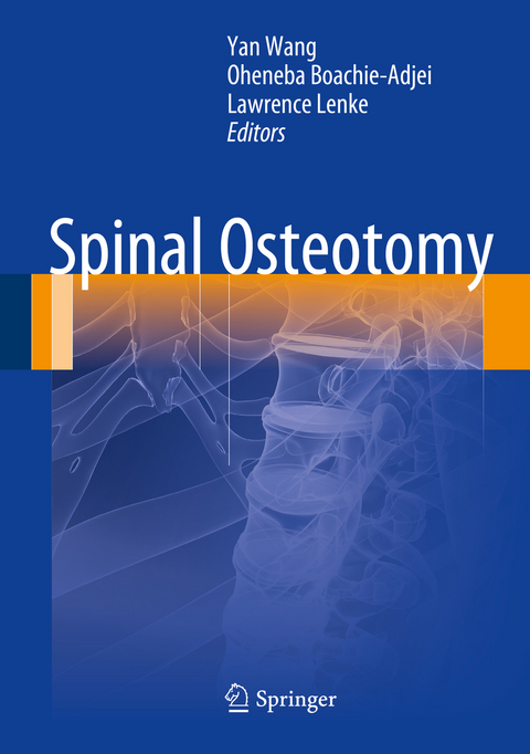 Spinal Osteotomy - 