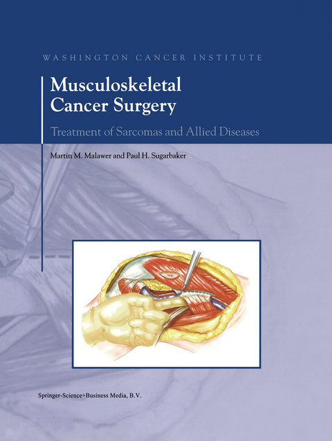 Musculoskeletal Cancer Surgery - 