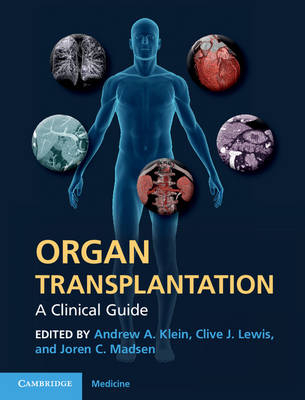 Organ Transplantation - 