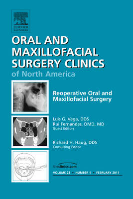 Reoperative Oral and Maxillofacial Surgery, An Issue of Oral and Maxillofacial Surgery Clinics - Rui Fernandes, Luis Vega