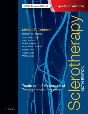 Sclerotherapy - Mitchel P. Goldman, Robert A Weiss