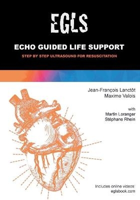 Echo Guided Life Support (EGLS) - Jean-François Lanctôt, Maxime Valois