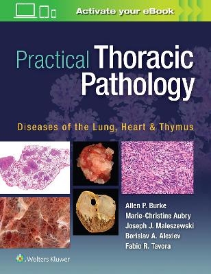 Practical Thoracic Pathology - Allen P. Burke, Marie-Christine Aubry, Joseph Maleszewski, Borislav Alexiev, Fabio Tavora