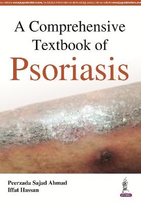 A Comprehensive Textbook of Psoriasis - Peerzada Sajad Ahmad, Iffat Hassan