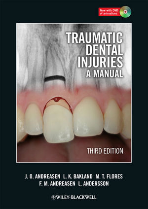 Traumatic Dental Injuries - Jens O. Andreasen, Leif K. Bakland, Maria Teresa Flores, Frances M. Andreasen, Lars Andersson