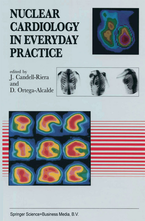 Nuclear Cardiology in Everyday Practice - 