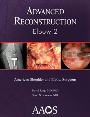 Advanced Reconstruction: Elbow 2 - 