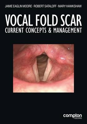 Vocal Fold Scar - 
