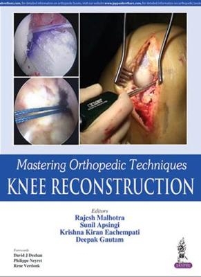 Mastering Orthopedic Techniques: Knee Reconstruction - Rajesh Malhotra, Sunil Apsingi, Krishna Kiran Eachempati, Deepak Gautam