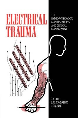 Electrical Trauma - 