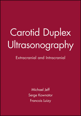 Carotid Duplex Ultrasonography - Michael Jeff, Serge Kownator, Francois Luizy