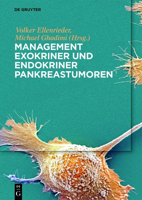 Management exokriner und endokriner Pankreastumoren - 