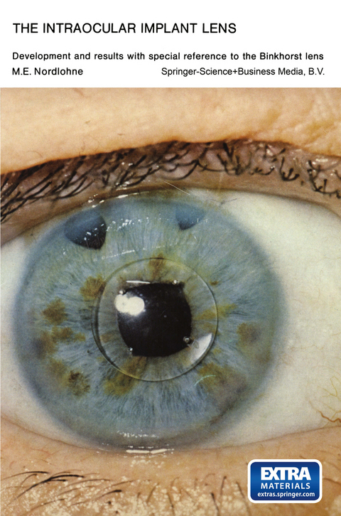 The Intraocular Implant Lens Development and Results with Special Reference to the Binkhorst Lens - Marcel Eugène Nordlohne