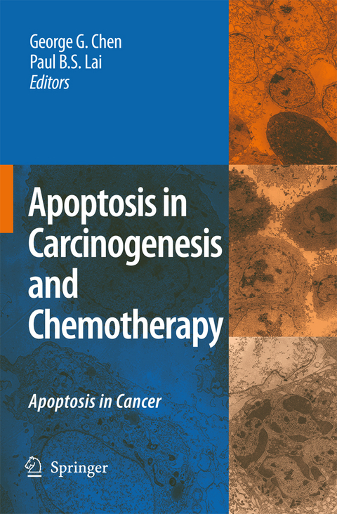 Apoptosis in Carcinogenesis and Chemotherapy - 