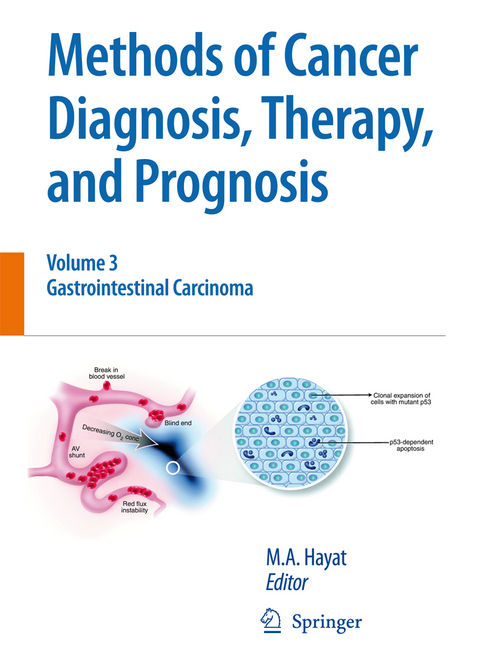 Methods of Cancer Diagnosis, Therapy and Prognosis - 