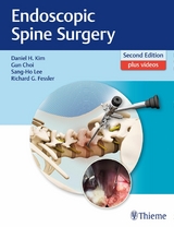 Endoscopic Spine Surgery - 