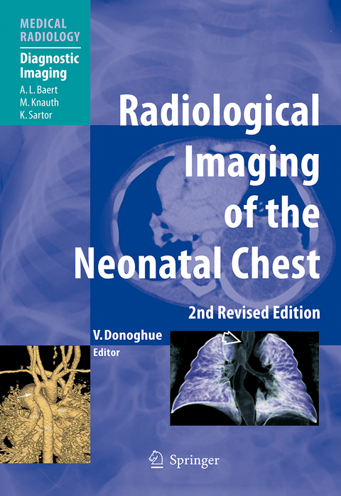 Radiological Imaging of the Neonatal Chest - 