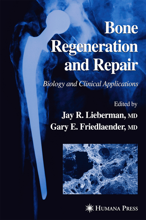Bone Regeneration and Repair - 