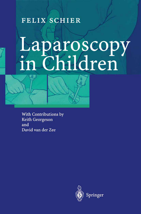 Laparoscopy in Children - Felix Schier