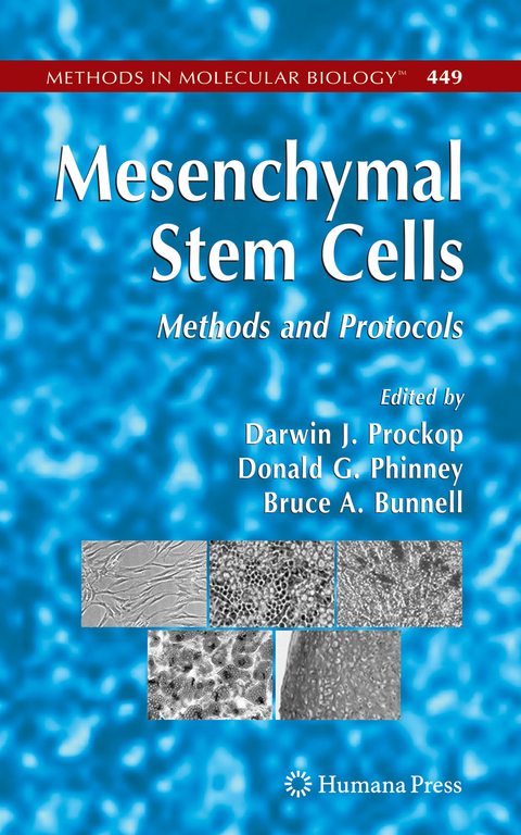 Mesenchymal Stem Cells - 