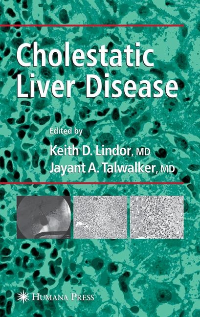Cholestatic Liver Disease - 