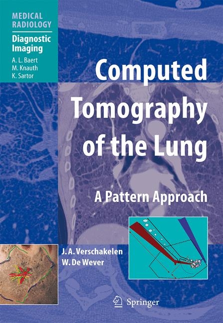 Computed Tomography of the Lung - Johny A. Verschakelen, Walter de Wever
