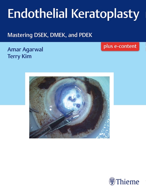 Endothelial Keratoplasty - Amar Agarwal, Terry Kim