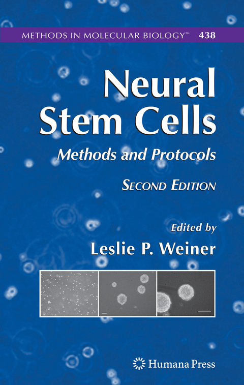 Neural Stem Cells - 