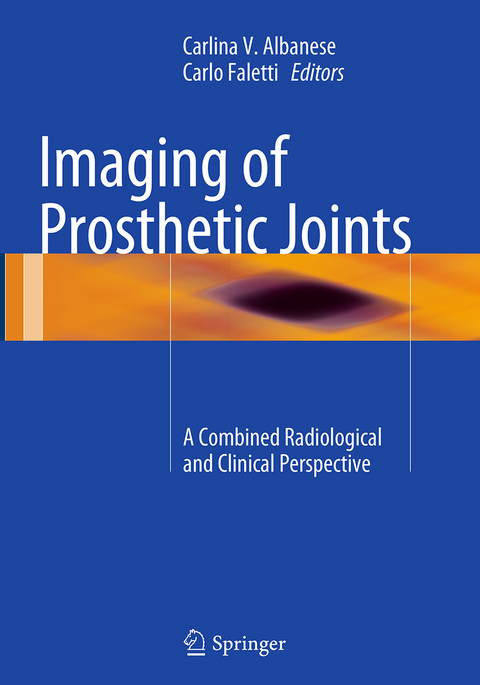 Imaging of Prosthetic Joints - 