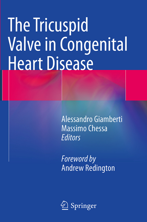 The Tricuspid Valve in Congenital Heart Disease - 