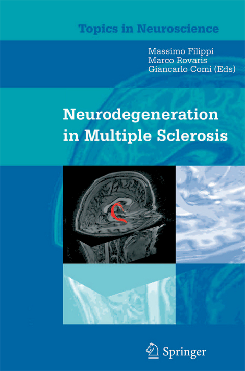 Neurodegeneration in Multiple Sclerosis - 