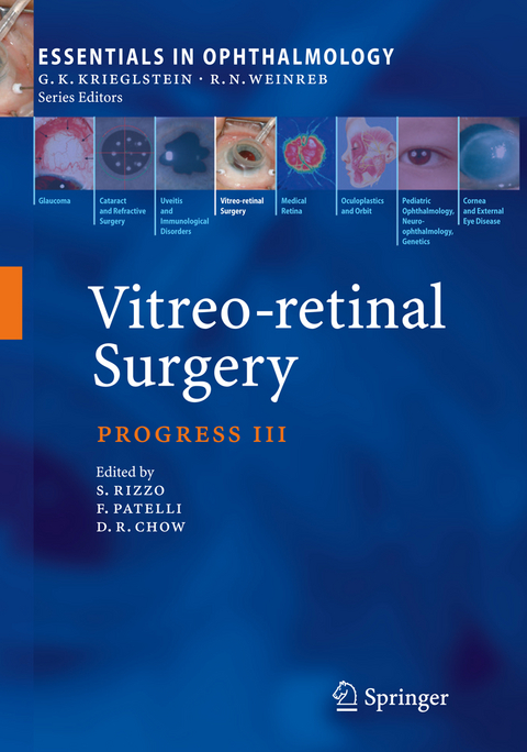 Vitreo-retinal Surgery - 