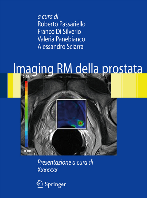 Imaging RM della prostata - 