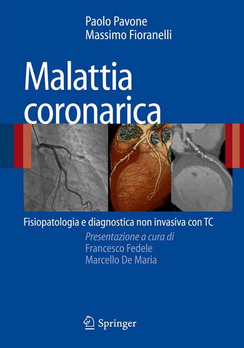 Malattia coronarica - Paolo Pavone, Massimo Fioranelli