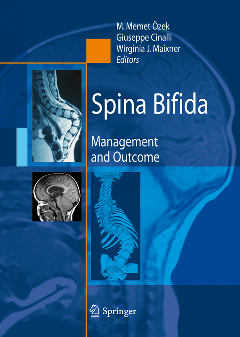 Spina Bifida - 