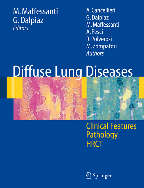 Diffuse Lung Diseases - 