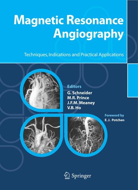 Magnetic Resonance Angiography - 