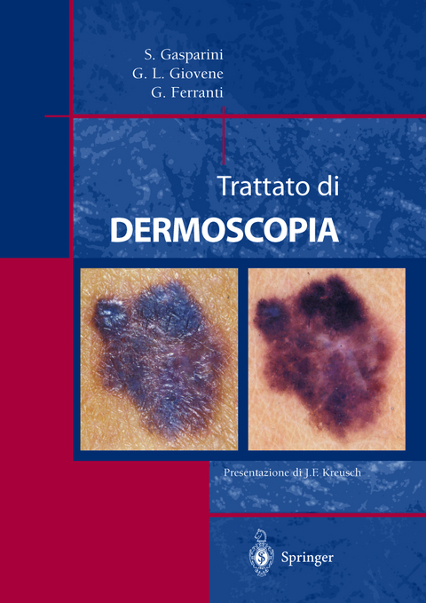 Trattato di Dermoscopia - Saturnino Gasparini, Gian Luigi Giovene, Giulio Ferranti