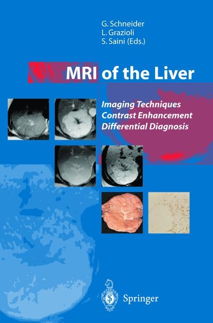 MRI of the Liver - 