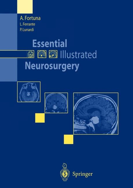 Essential Illustrated Neurosurgery - A. Fortuna, L. Ferrante, P. Lunardi