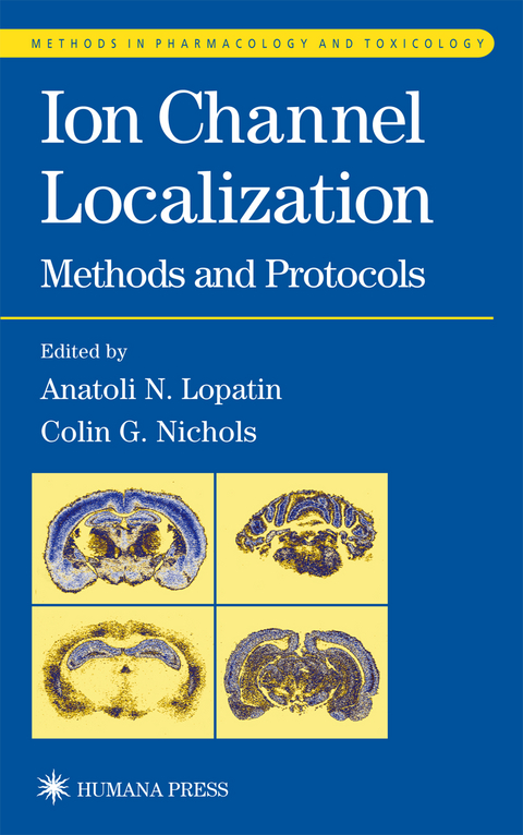 Ion Channel Localization - 