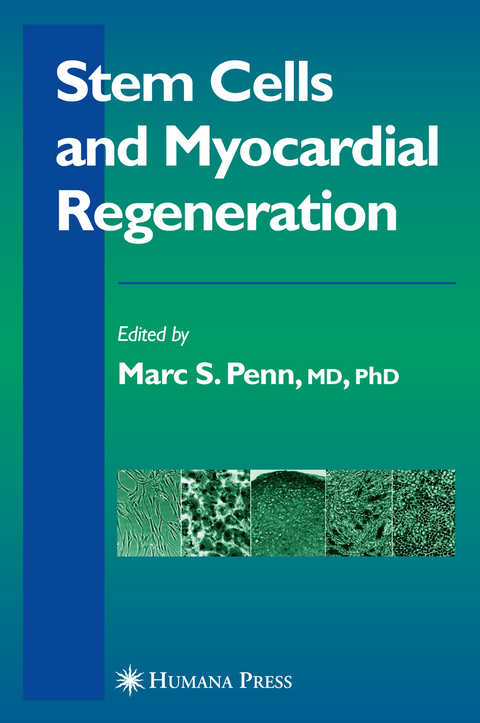 Stem Cells and Myocardial Regeneration - 