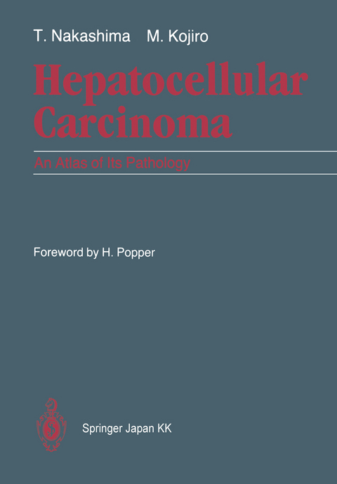 Hepatocellular Carcinoma - Toshiro Nakashima, Masamichi Kojiro