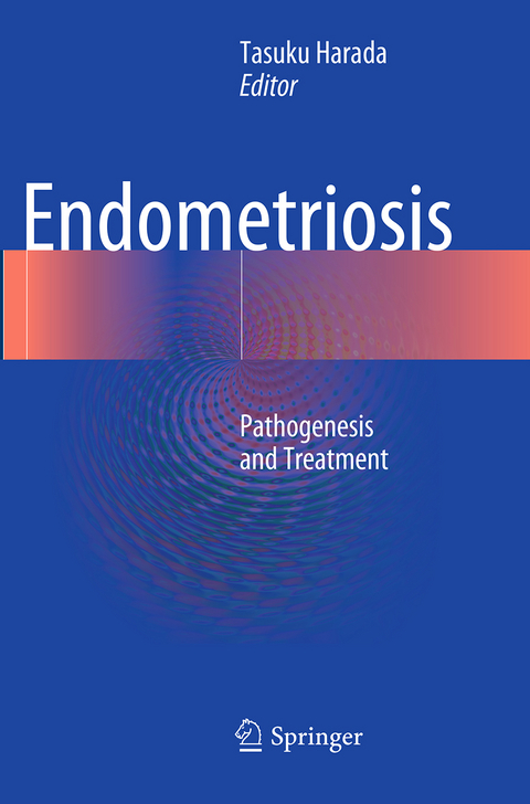 Endometriosis - 