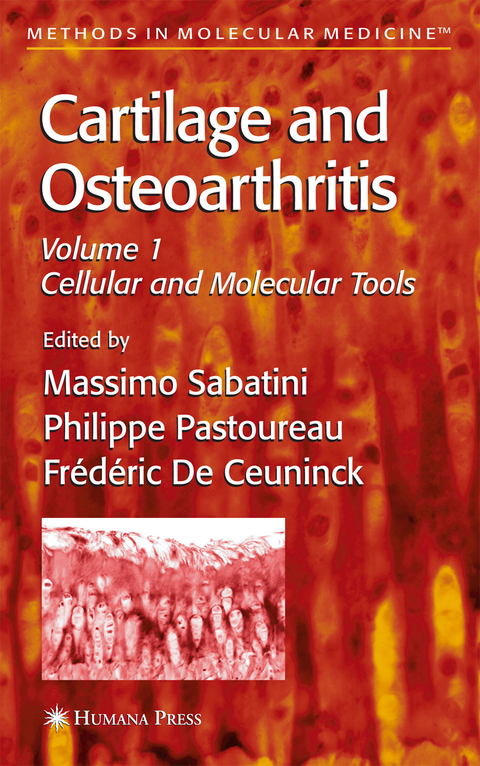 Cartilage and Osteoarthritis - 