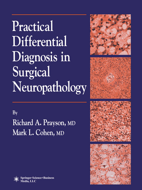 Practical Differential Diagnosis in Surgical Neuropathology - Richard A. Prayson, Mark L. Cohen