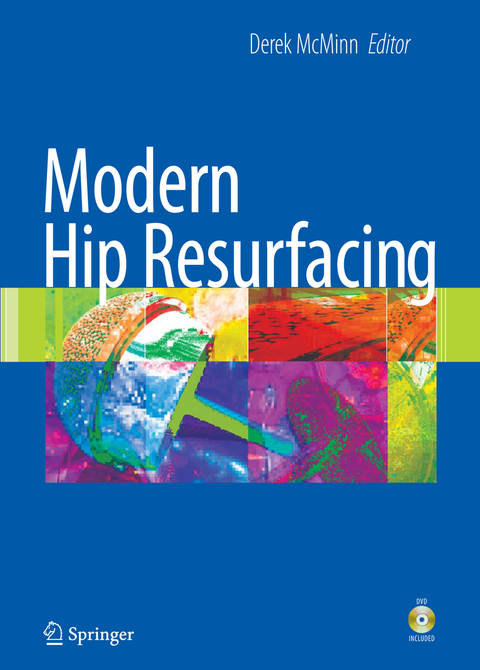 Modern Hip Resurfacing - 
