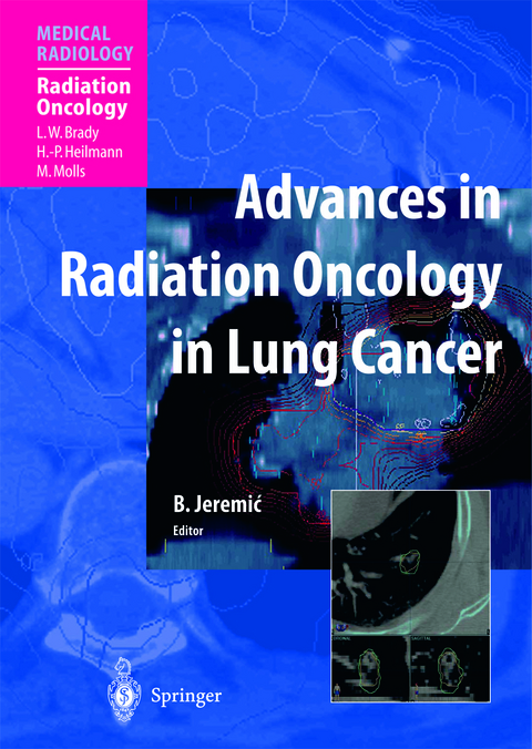 Advances in Radiation Oncology in Lung Cancer - 